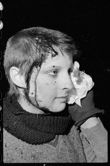 Image: Karen Brough, injured during an anti Springbok rugby tour demonstration in Wellington - Photograph taken by Ian Mackley