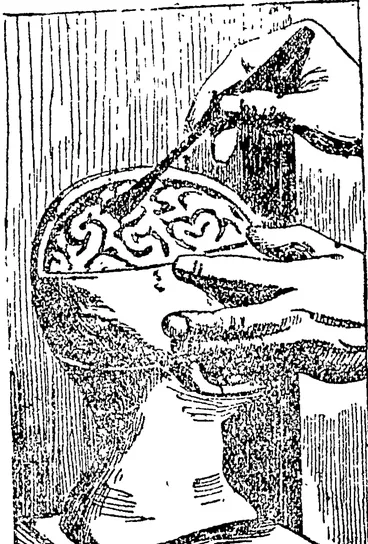 Image: Showing the brain centre, injury to which causes loss of self-control. (Auckland Star, 13 June 1903)