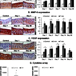 Ocular SM exposure causes increased expression of COX-2, VEGF, MMP-9, and IL-8.