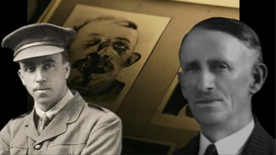 Great War Stories 1 - Harold Gillies and Henry Pickerill