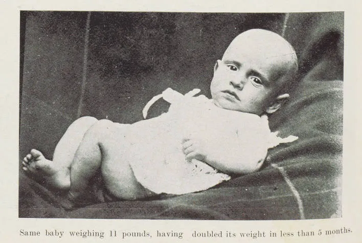 Same baby weighing 11 pounds, having doubled its weight in less than 5 months