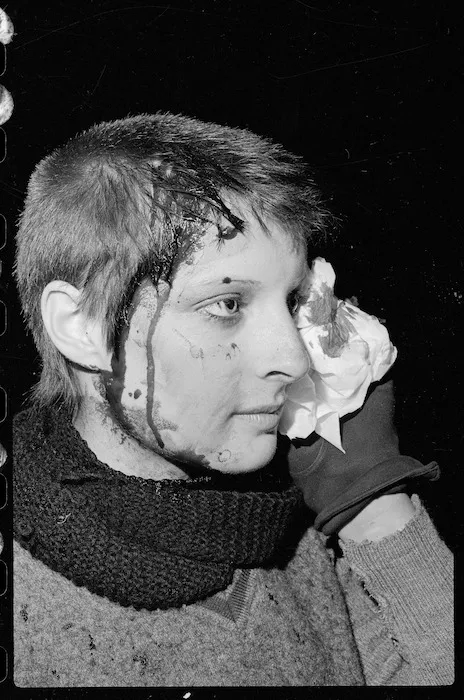 Karen Brough, injured during an anti Springbok rugby tour demonstration in Wellington - Photograph taken by Ian Mackley