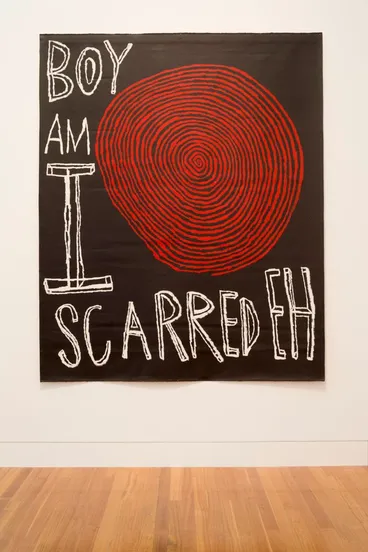 Image: Boy Am I Scarred Eh