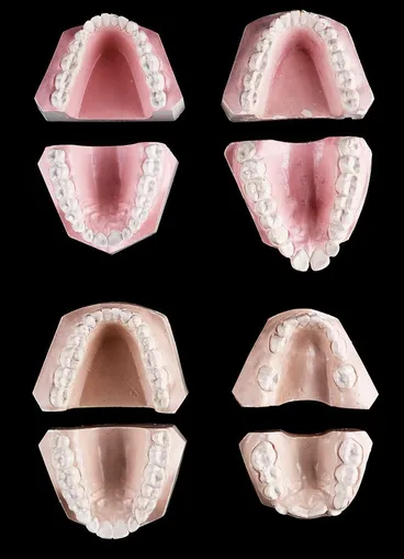Image: Model Teeth