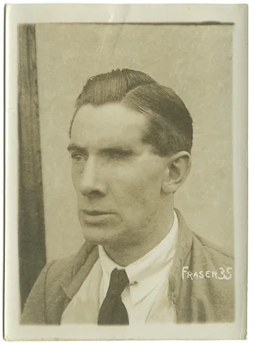 Wounded soldier Image: Wounded soldier