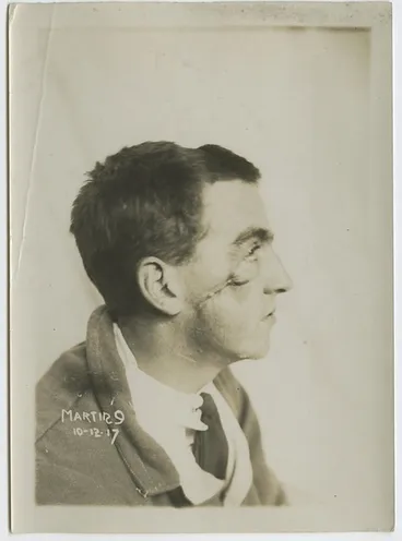 Wounded soldier Image: Wounded soldier