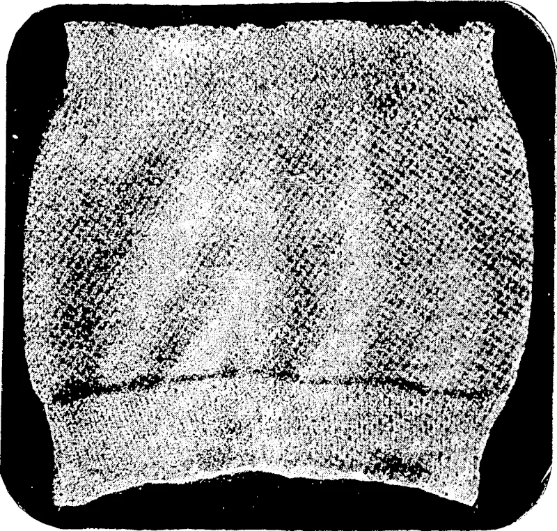 CHOLERA BELT (FOR SOLDIERS.) (Observer, 05 June 1915)