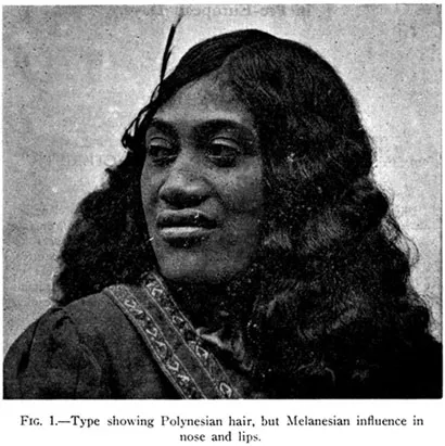 Fig. 1.—Type showing Polynesian hair, but Melanesian influence in nose and lips